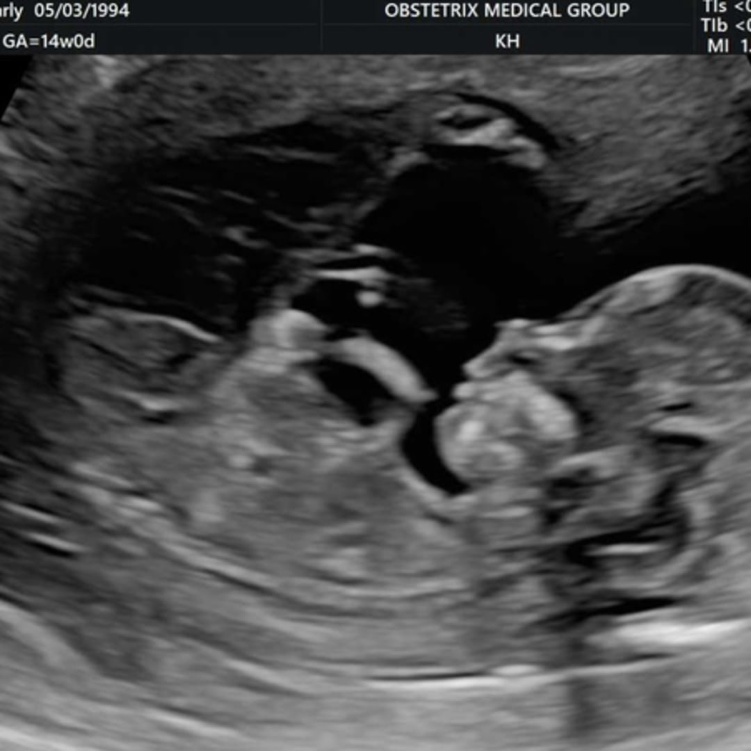 Photo shared by Carly for their Babylist baby registry.