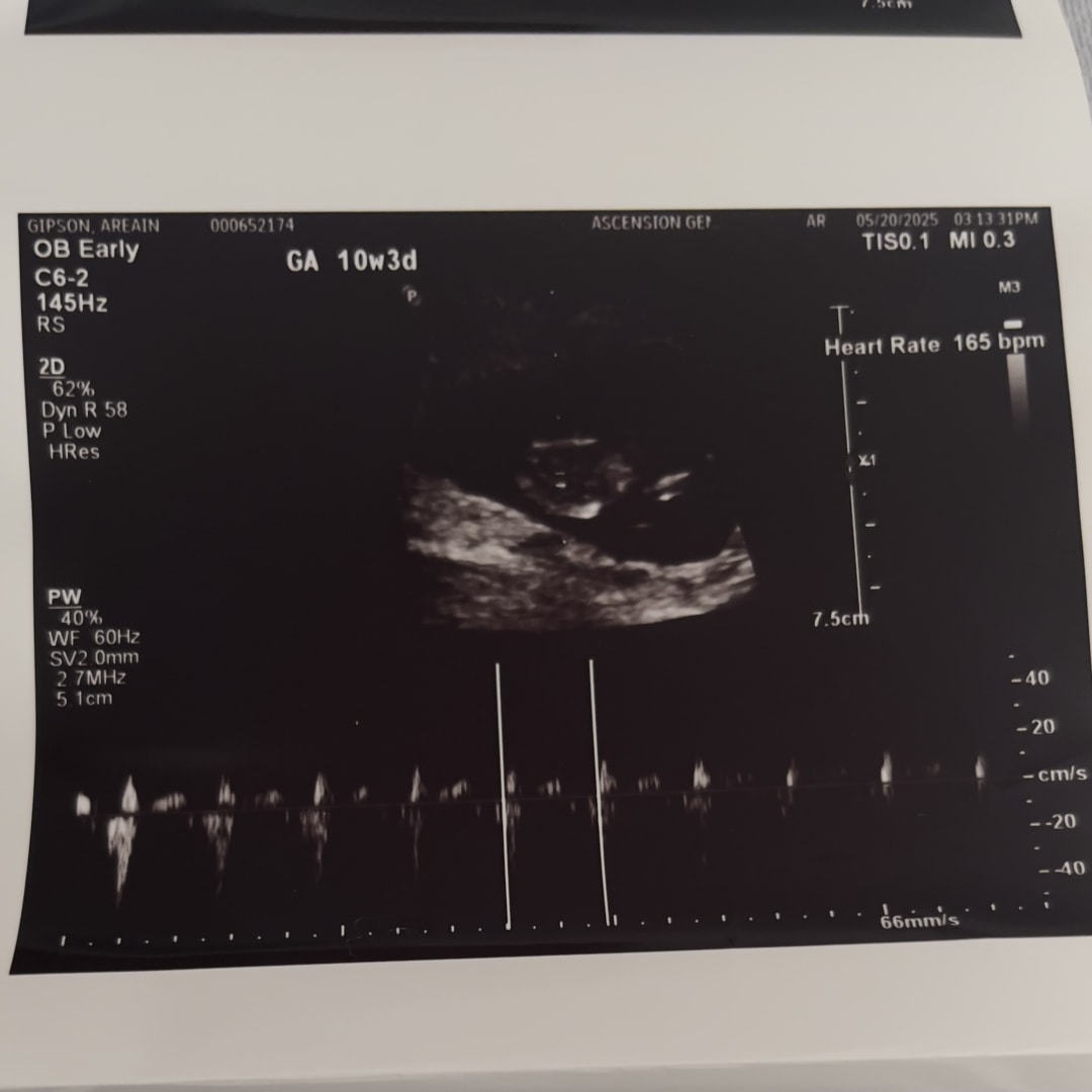 Photo shared by Areain for their Babylist baby registry.