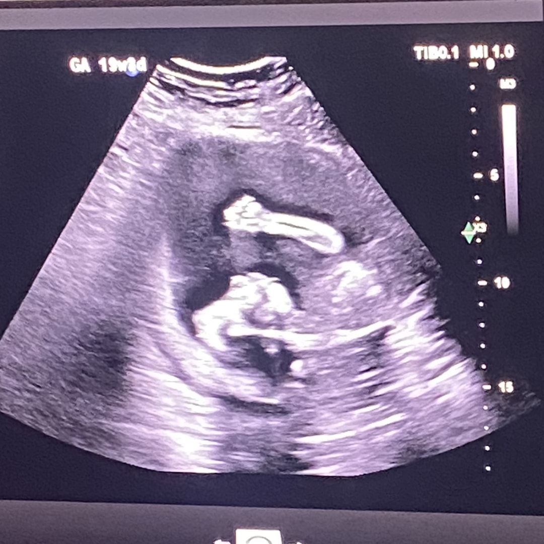 Photo shared by Bee for their Babylist baby registry.