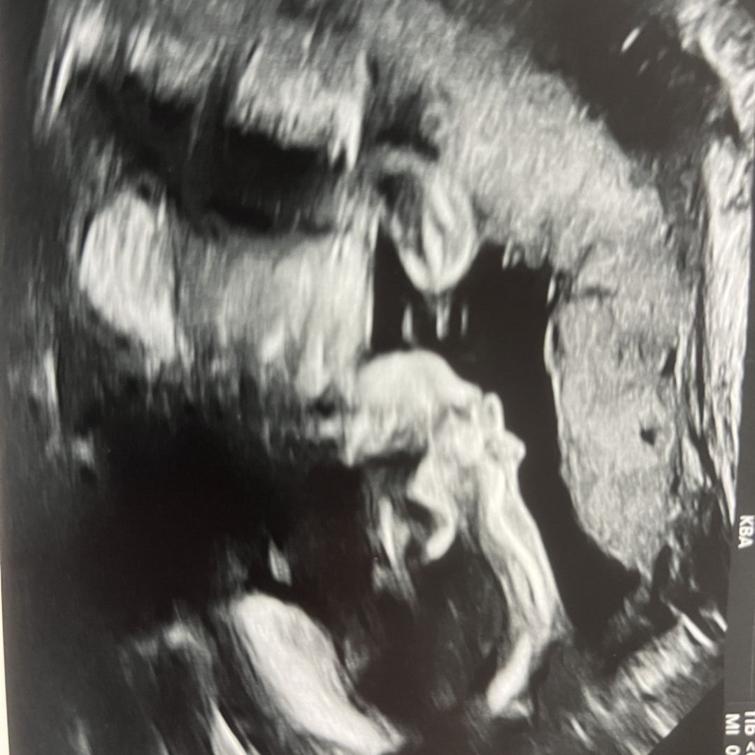 Photo shared by Mary for their Babylist baby registry.