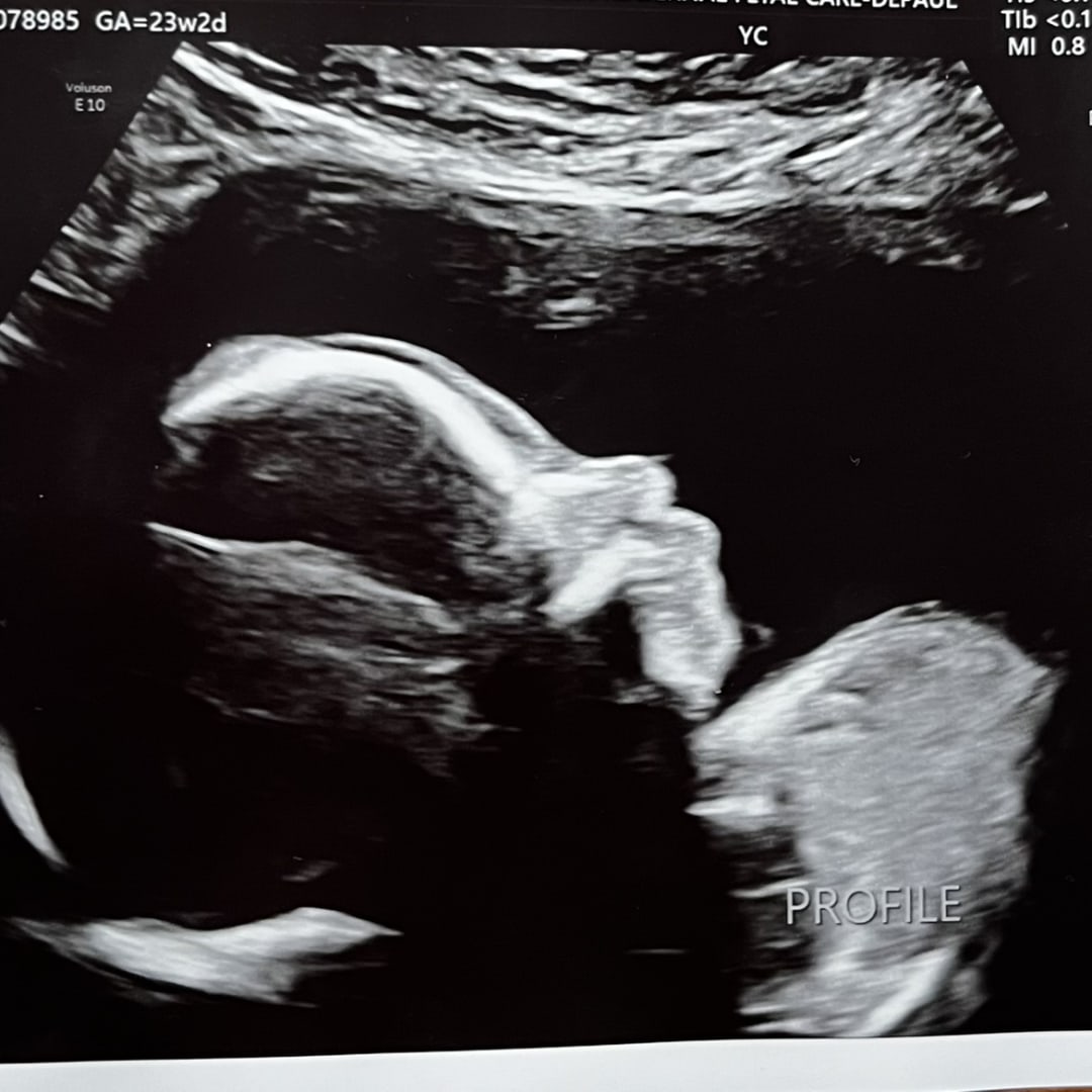 Photo shared by Jing for their Babylist baby registry.