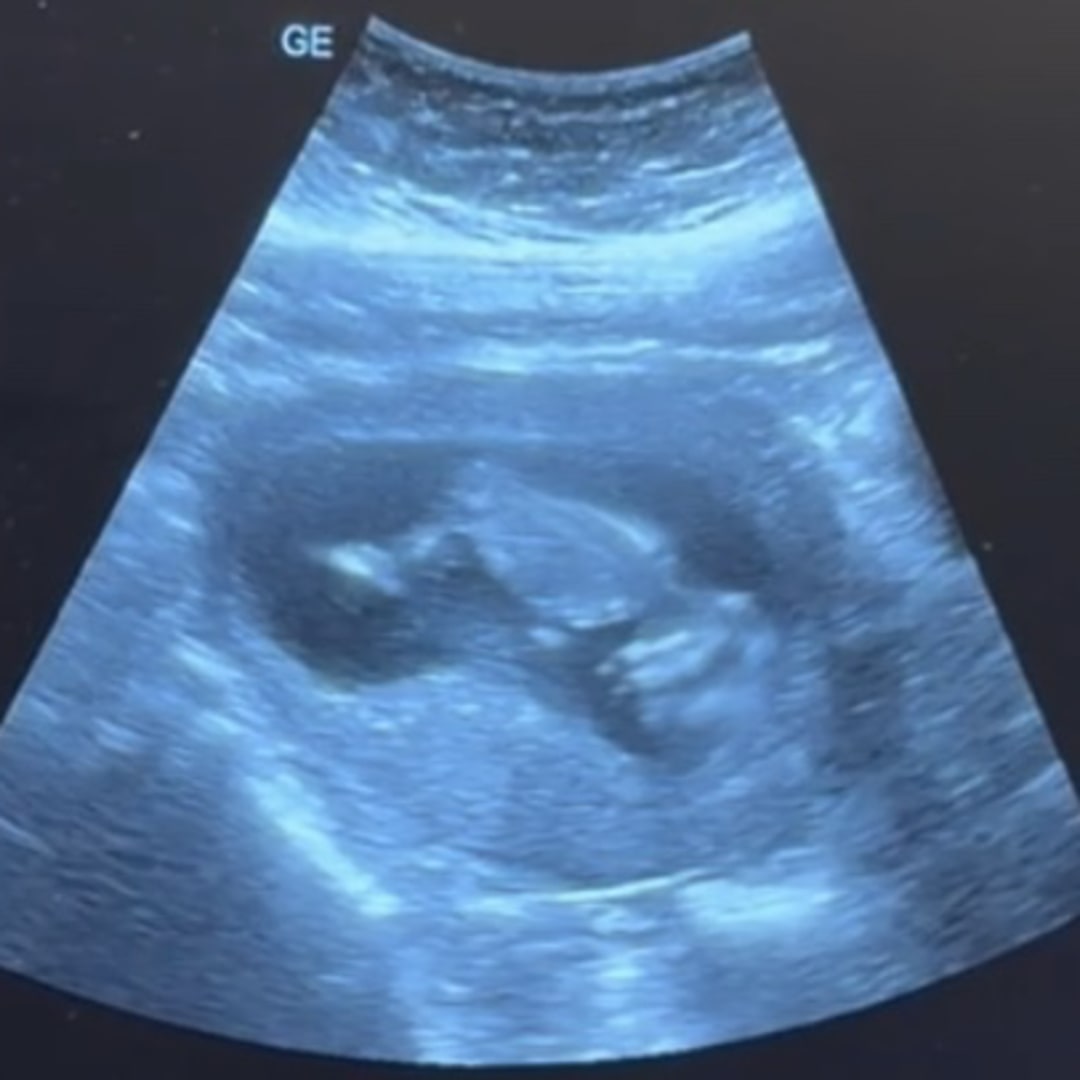 Photo shared by Kaitlin for their Babylist baby registry.