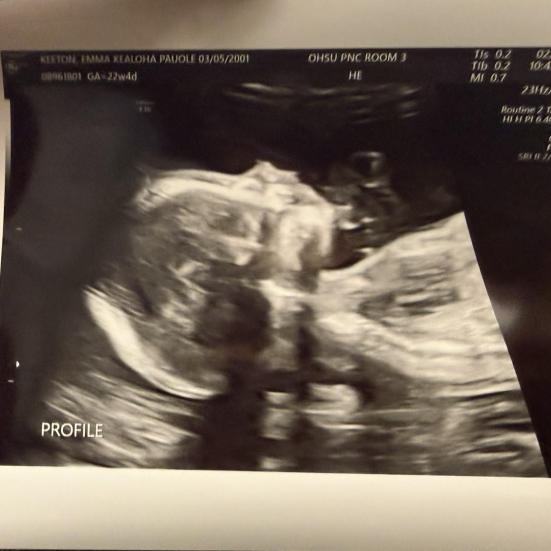 Photo shared by Emma for their Babylist baby registry.