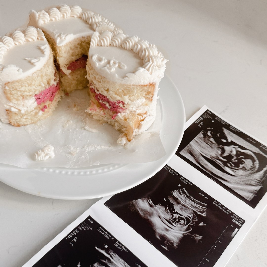 Photo shared by Claudia for their Babylist baby registry.