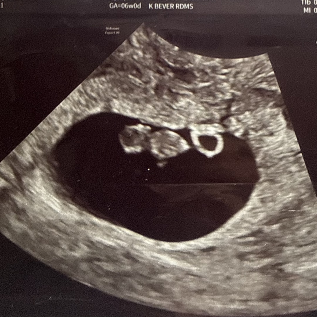 Photo shared by Lily for their Babylist baby registry.
