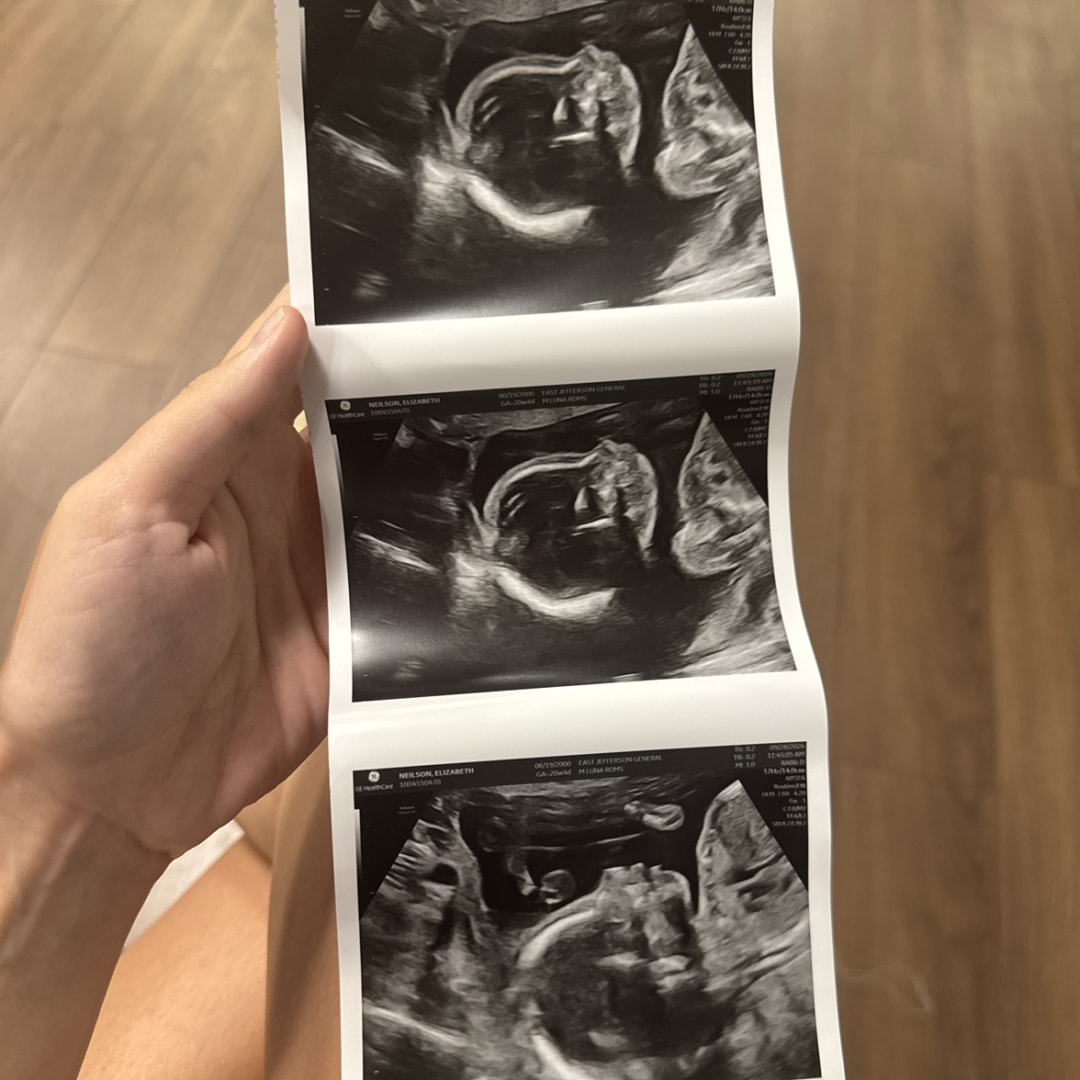 Photo shared by Elizabeth for their Babylist baby registry.