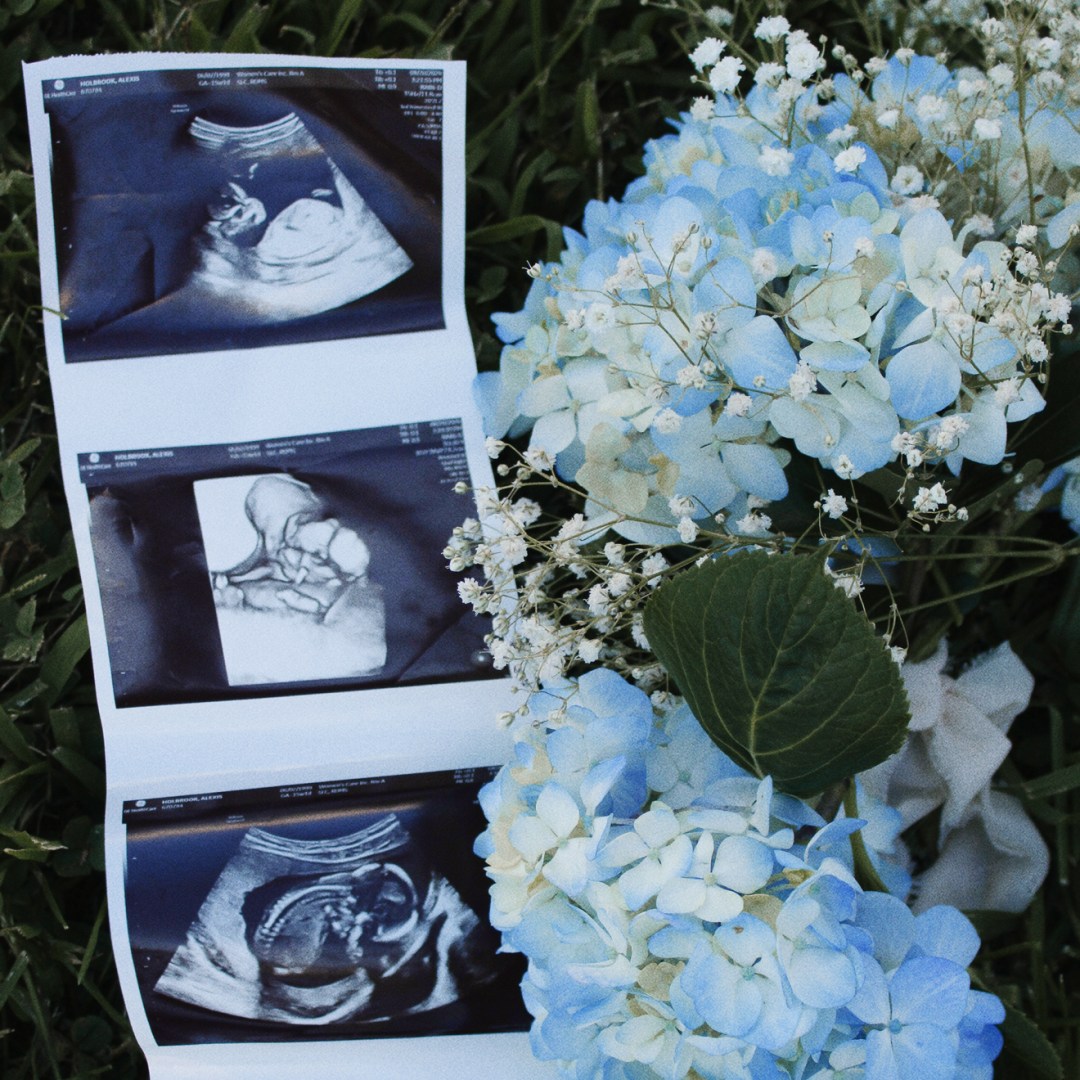 Photo shared by Alexis for their Babylist baby registry.