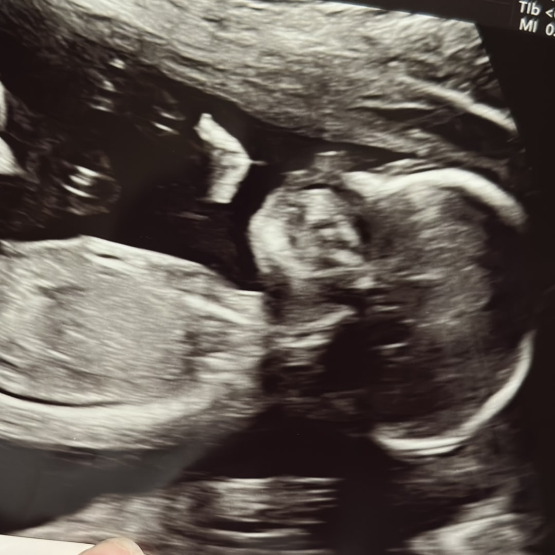 Photo shared by Alex for their Babylist baby registry.