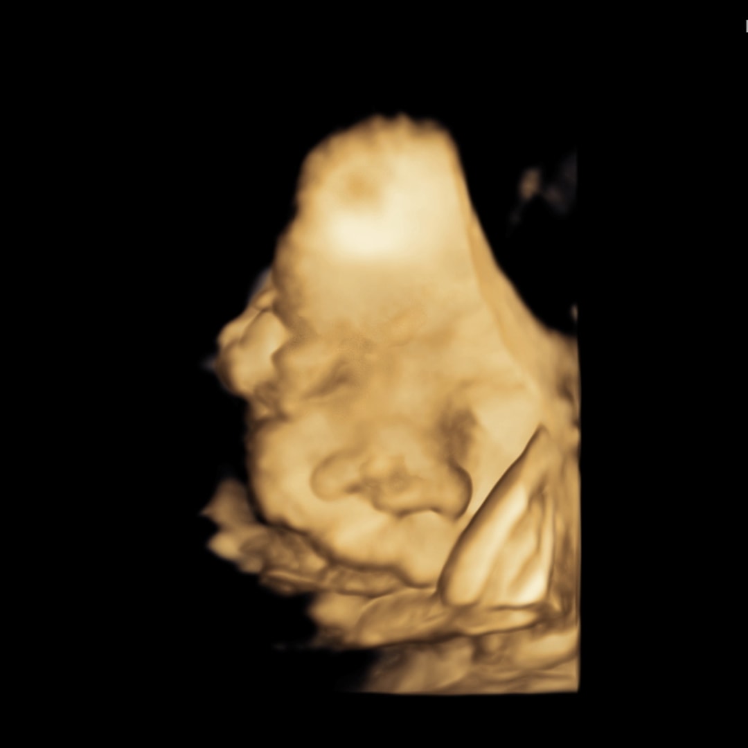 Photo shared by Norimar for their Babylist baby registry.