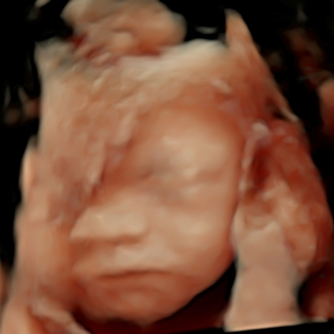 Photo shared by McKenzie for their Babylist baby registry.