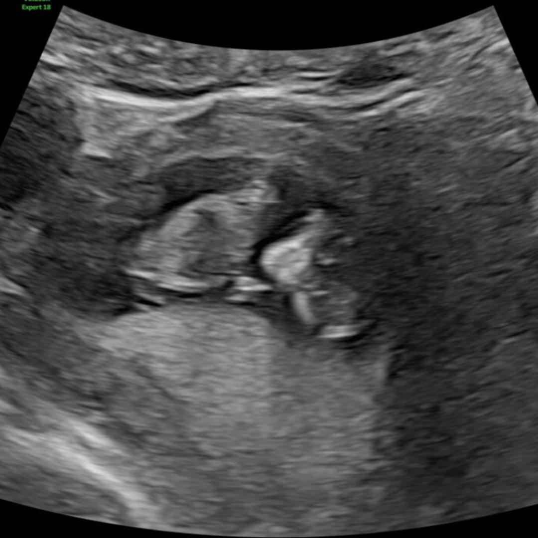 Photo shared by Haili for their Babylist baby registry.