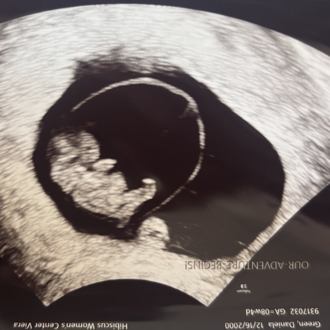 Photo shared by Daniela for their Babylist baby registry.