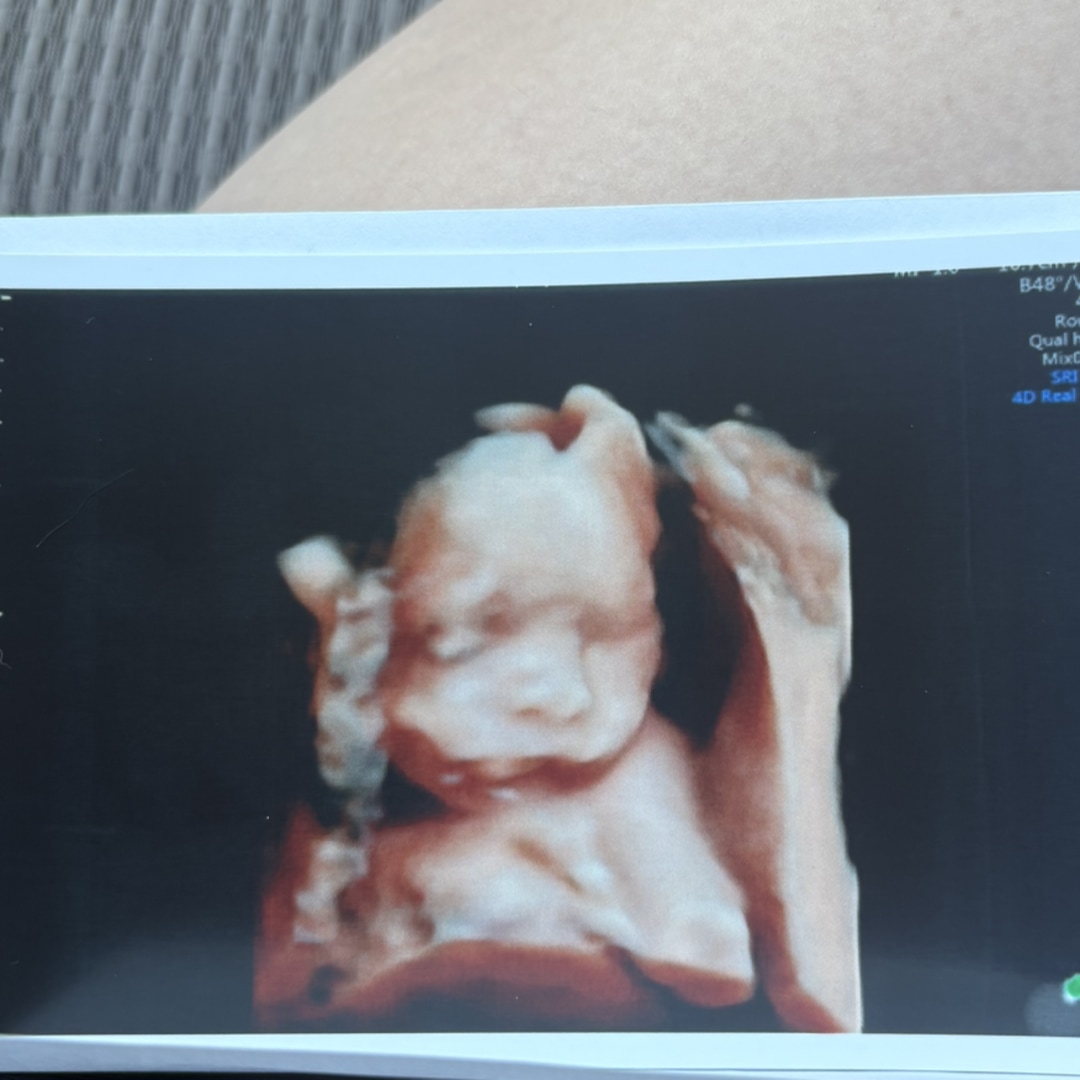 Photo shared by Alex for their Babylist baby registry.