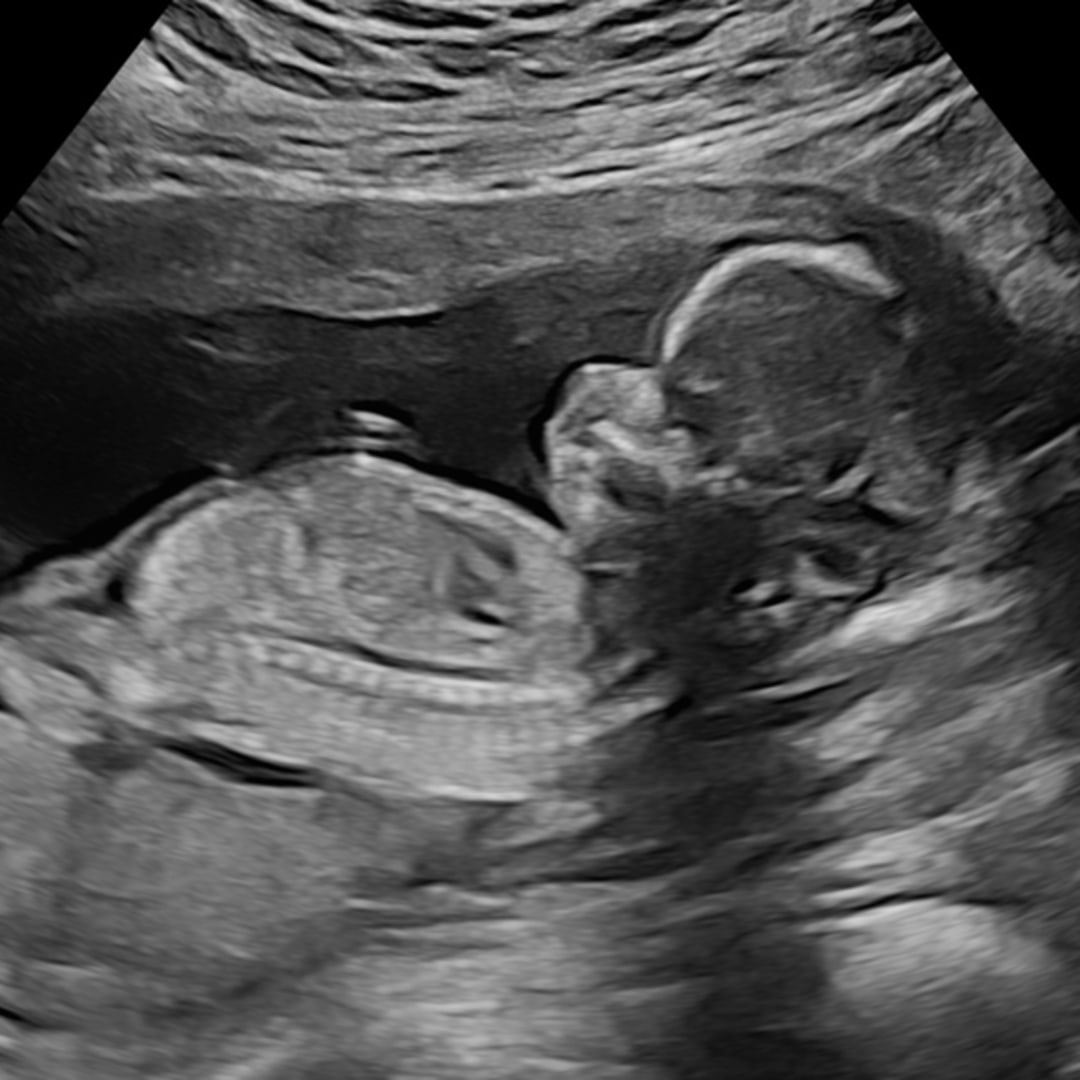 Photo shared by Abby for their Babylist baby registry.