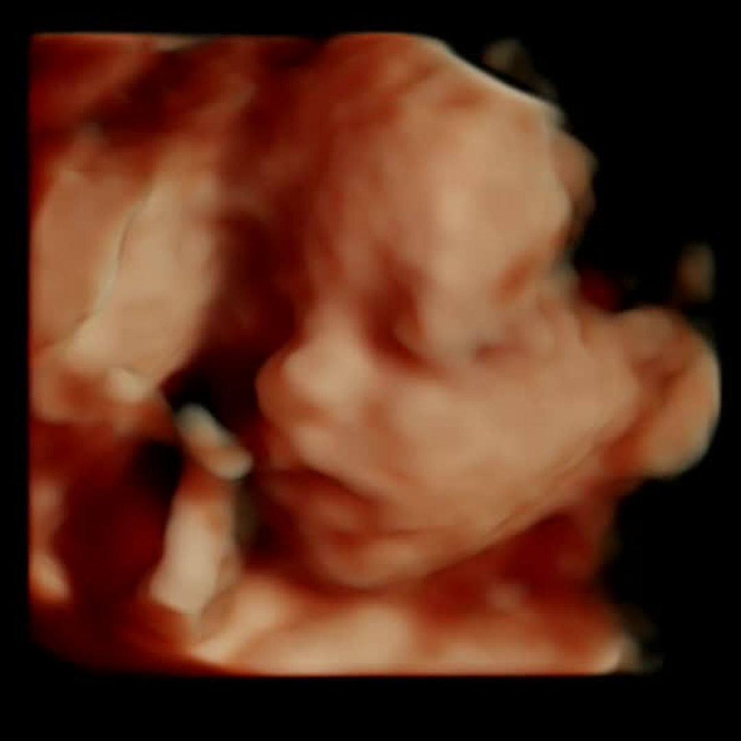 Photo shared by Destiny for their Babylist baby registry.