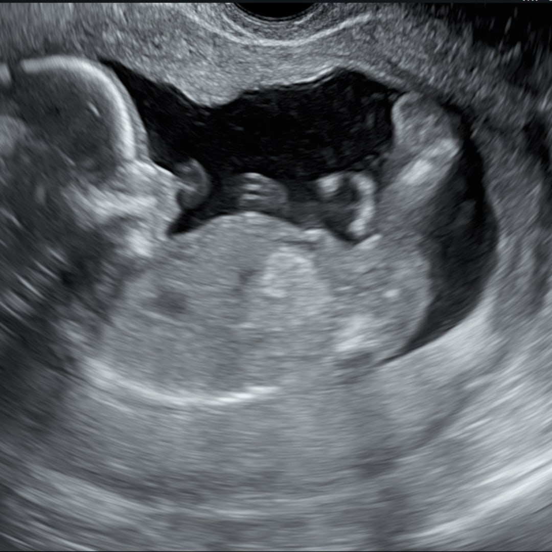 Photo shared by Kimberly for their Babylist baby registry.