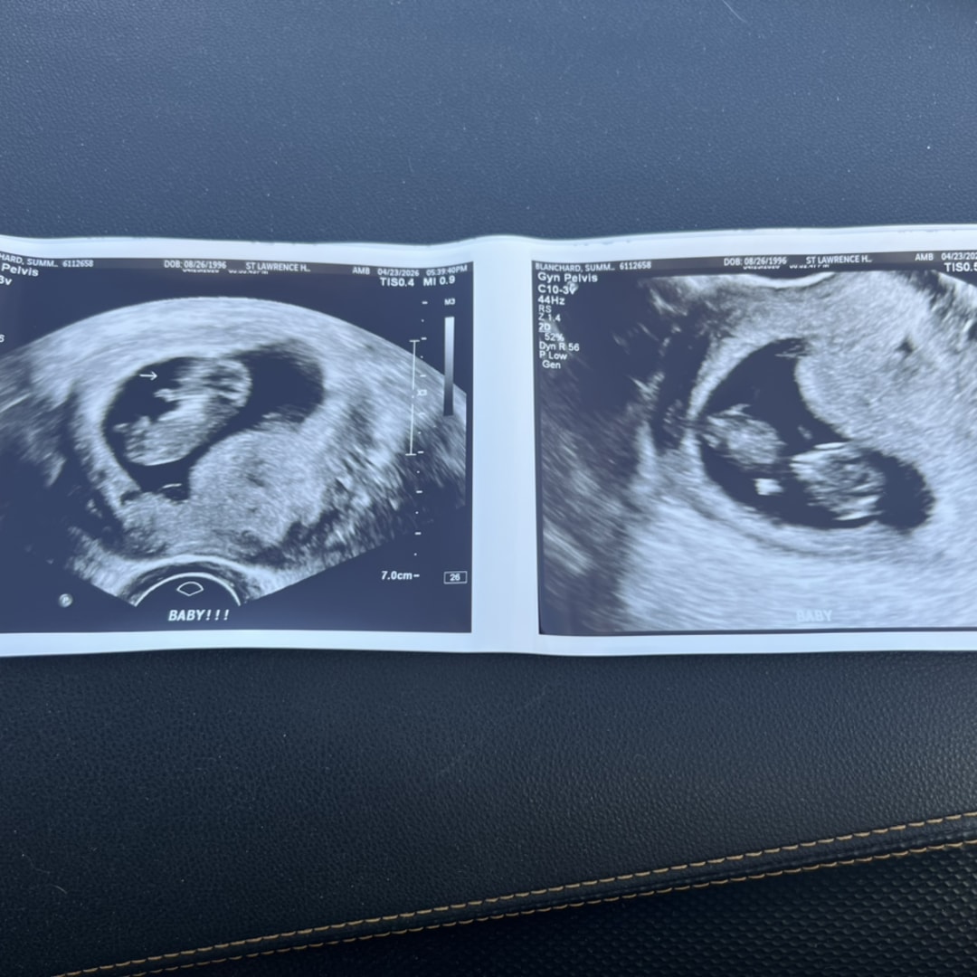 Photo shared by Summer for their Babylist baby registry.