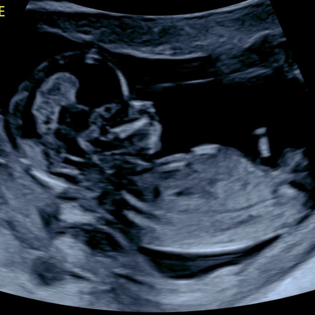 Photo shared by Fernando for their Babylist baby registry.