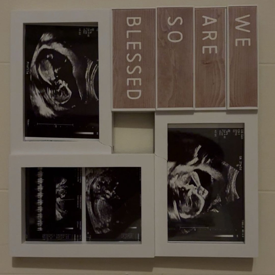 Photo shared by Cassidy for their Babylist baby registry.