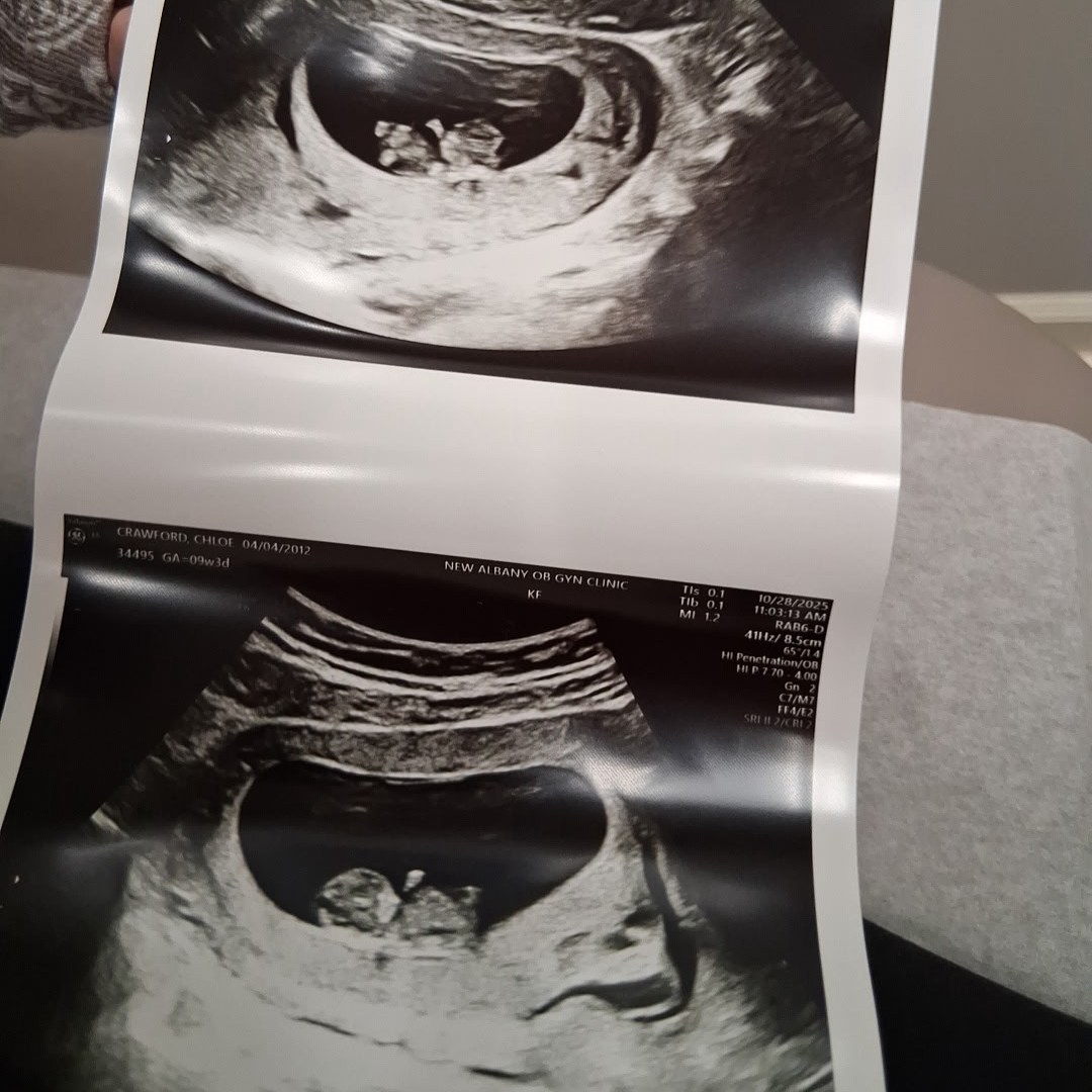 Photo shared by Chloe for their Babylist baby registry.