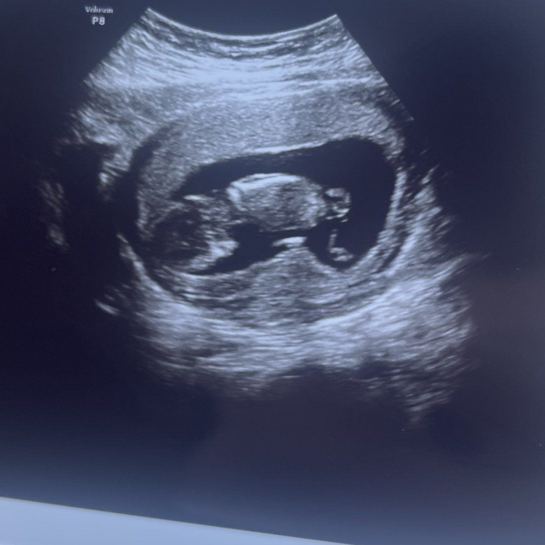 Photo shared by Stephanie for their Babylist baby registry.