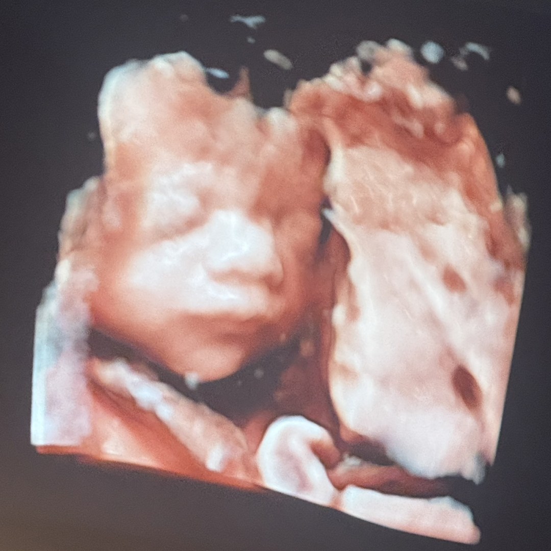 Photo shared by Grace for their Babylist baby registry.