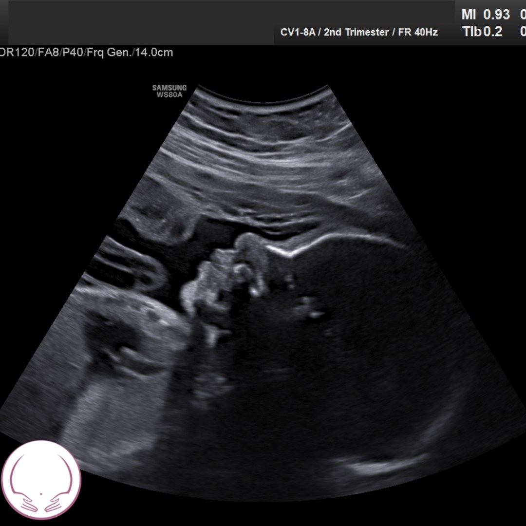 Photo shared by Kamya for their Babylist baby registry.