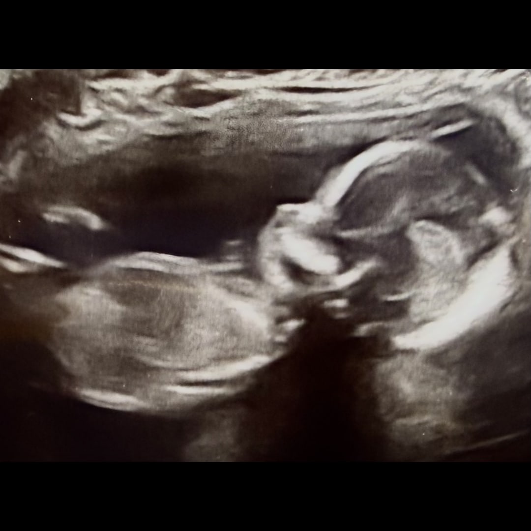 Photo shared by Matti for their Babylist baby registry.