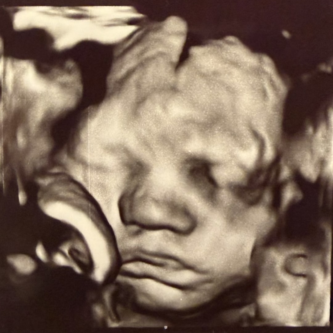 Photo shared by Lauren for their Babylist baby registry.