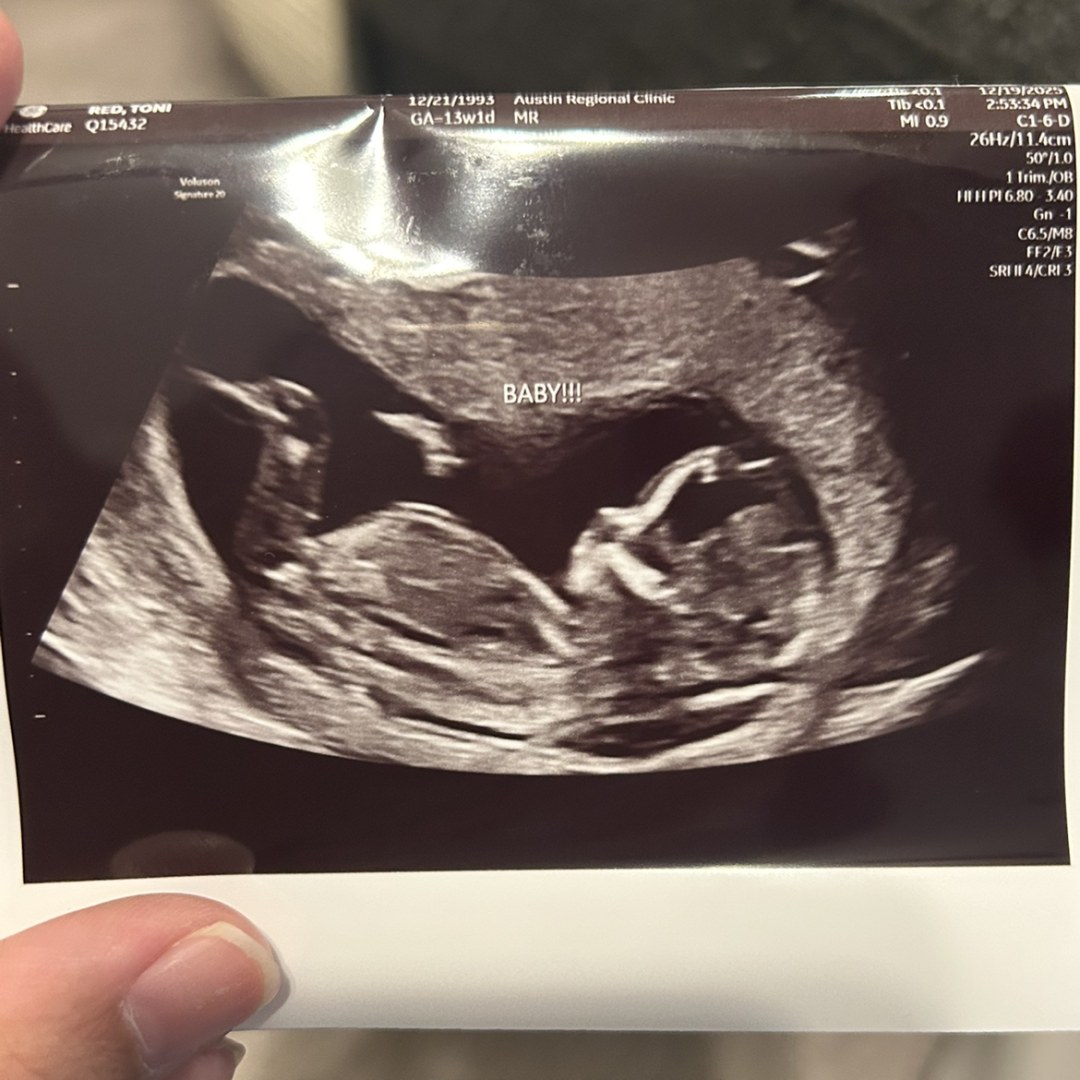 Photo shared by Mark for their Babylist baby registry.