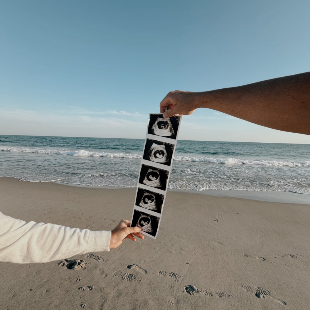Photo shared by Chloe for their Babylist baby registry.