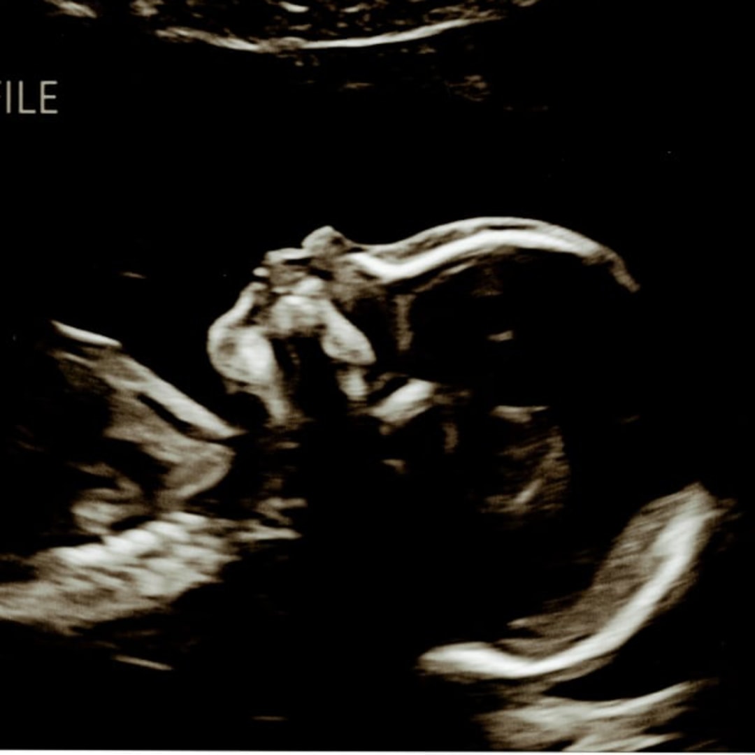 Photo shared by Jessica for their Babylist baby registry.