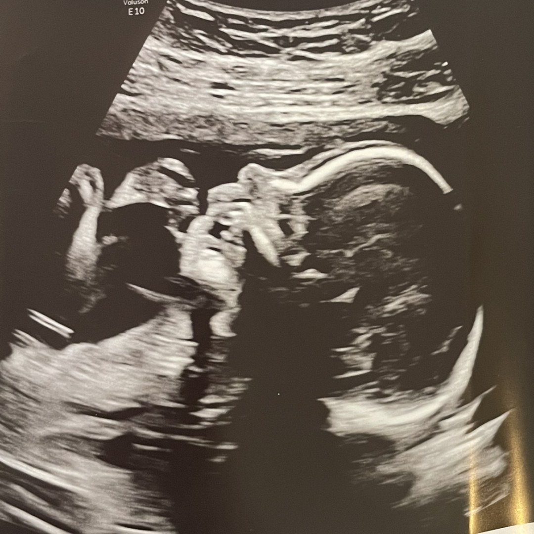 Photo shared by Savana for their Babylist baby registry.