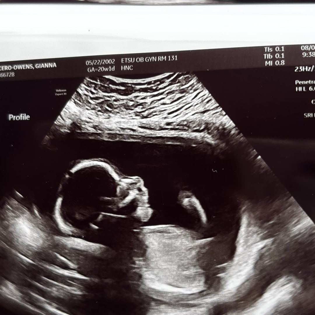 Photo shared by Garrett & Gianna for their Babylist baby registry.