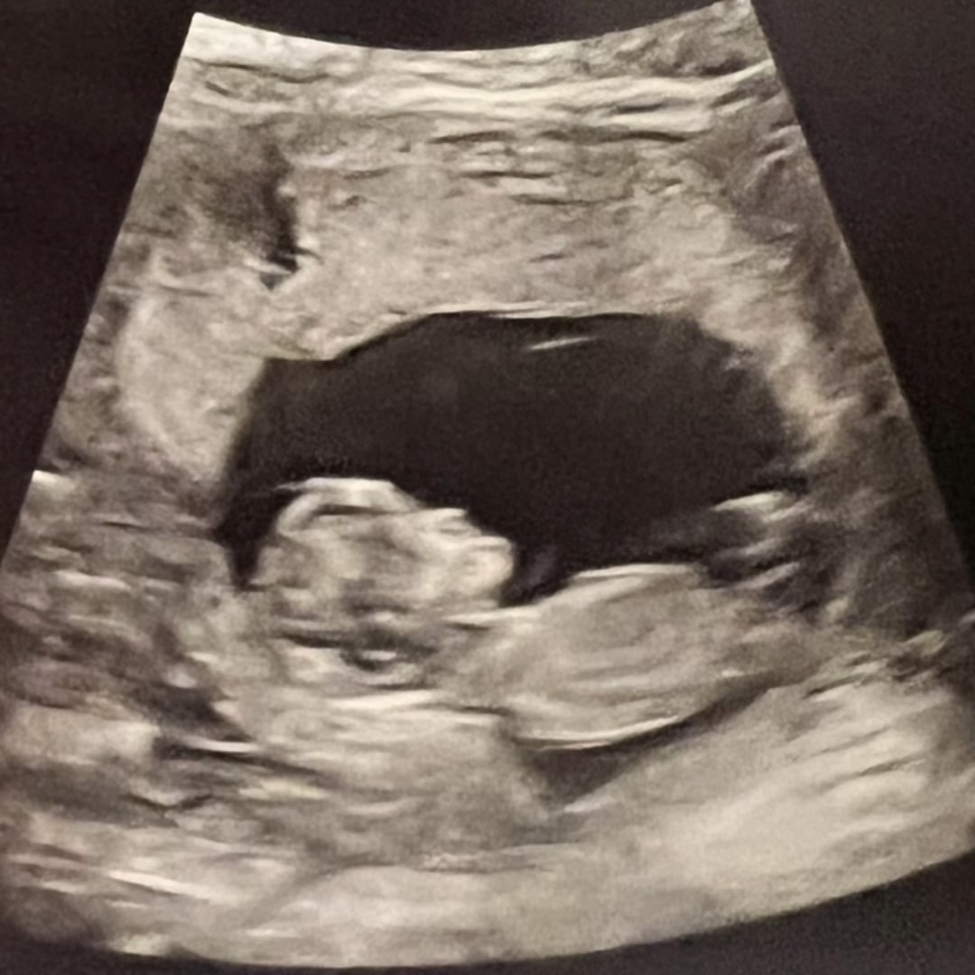 Photo shared by Victoria for their Babylist baby registry.