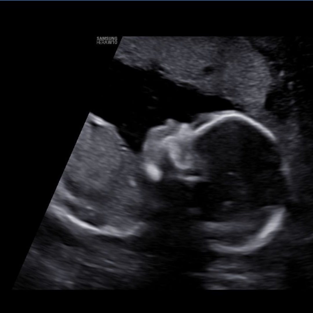 Photo shared by Katie for their Babylist baby registry.