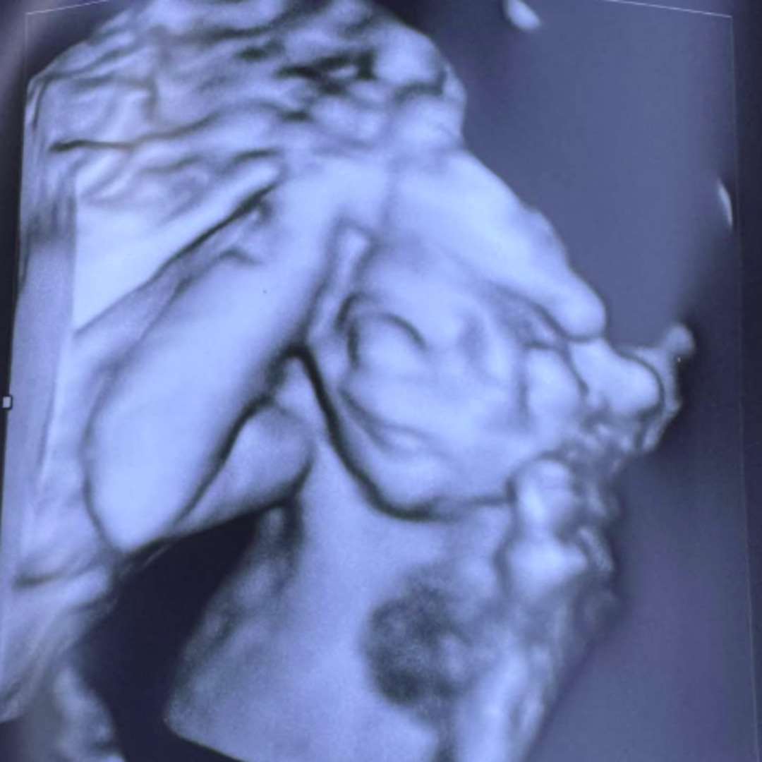 Photo shared by Ashley for their Babylist baby registry.