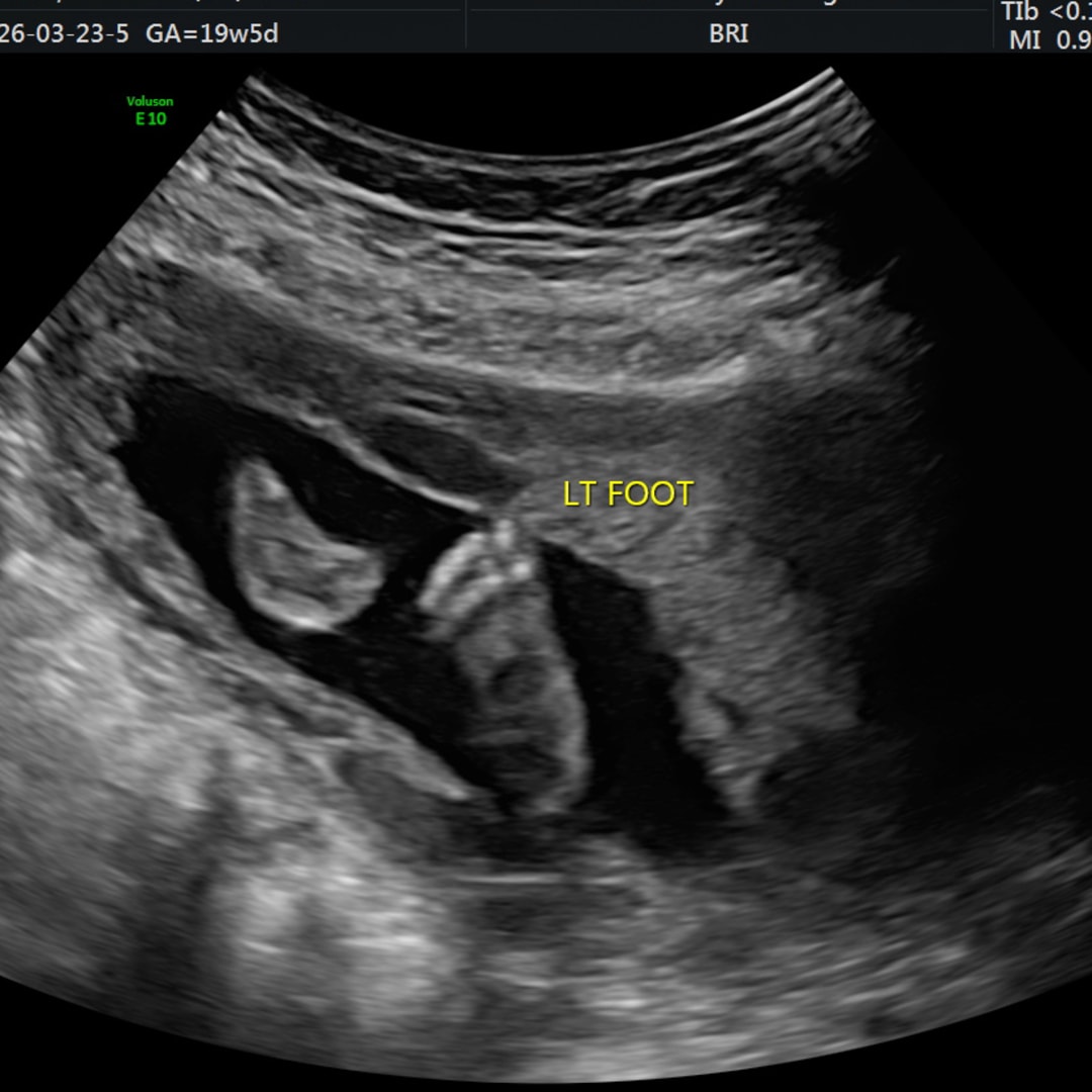Photo shared by Grace for their Babylist baby registry.
