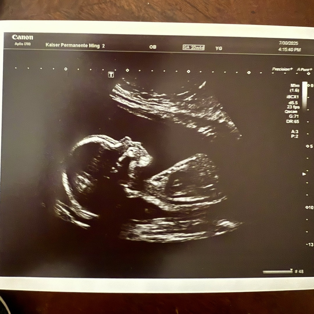 Photo shared by Cecilia for their Babylist baby registry.