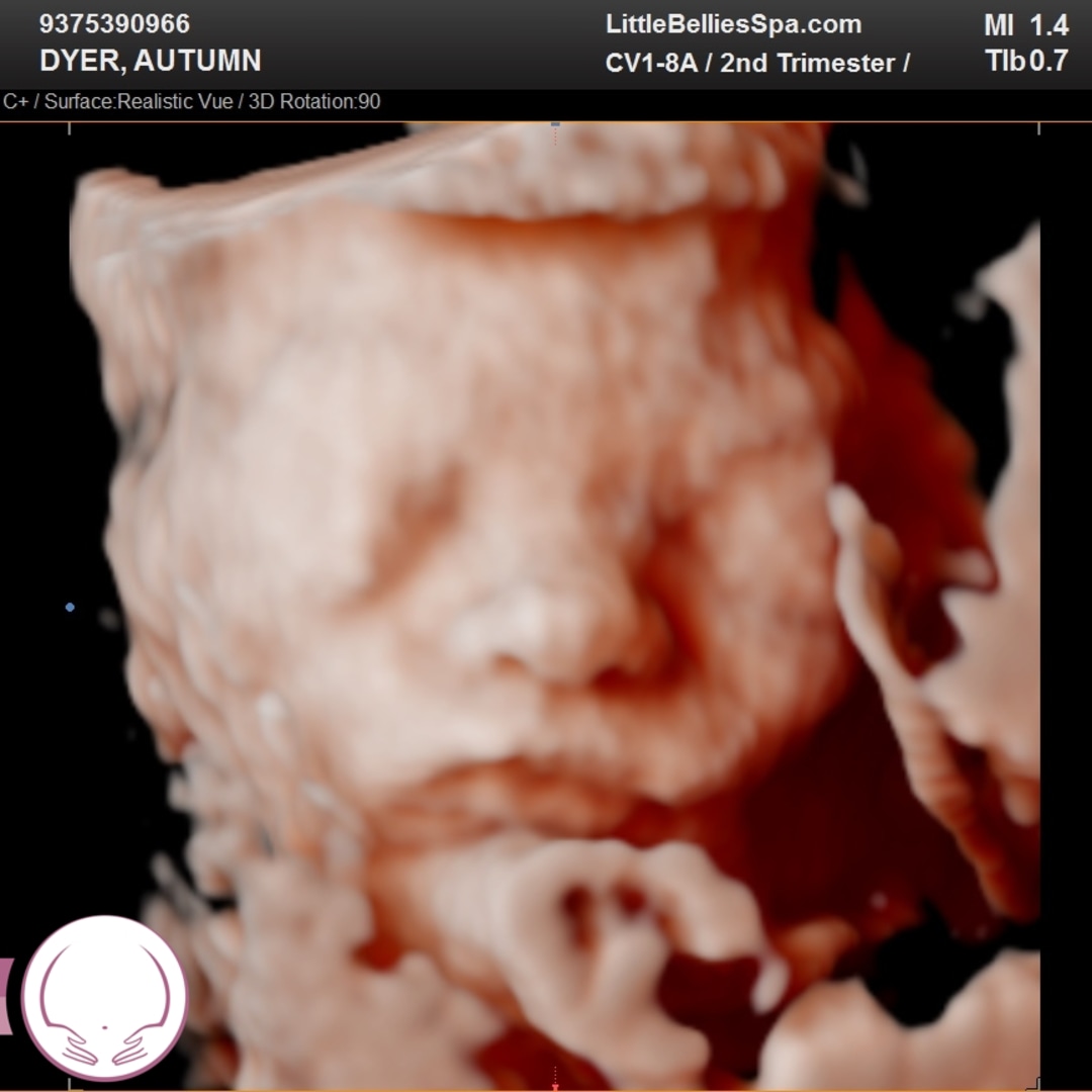 Photo shared by Autumn for their Babylist baby registry.