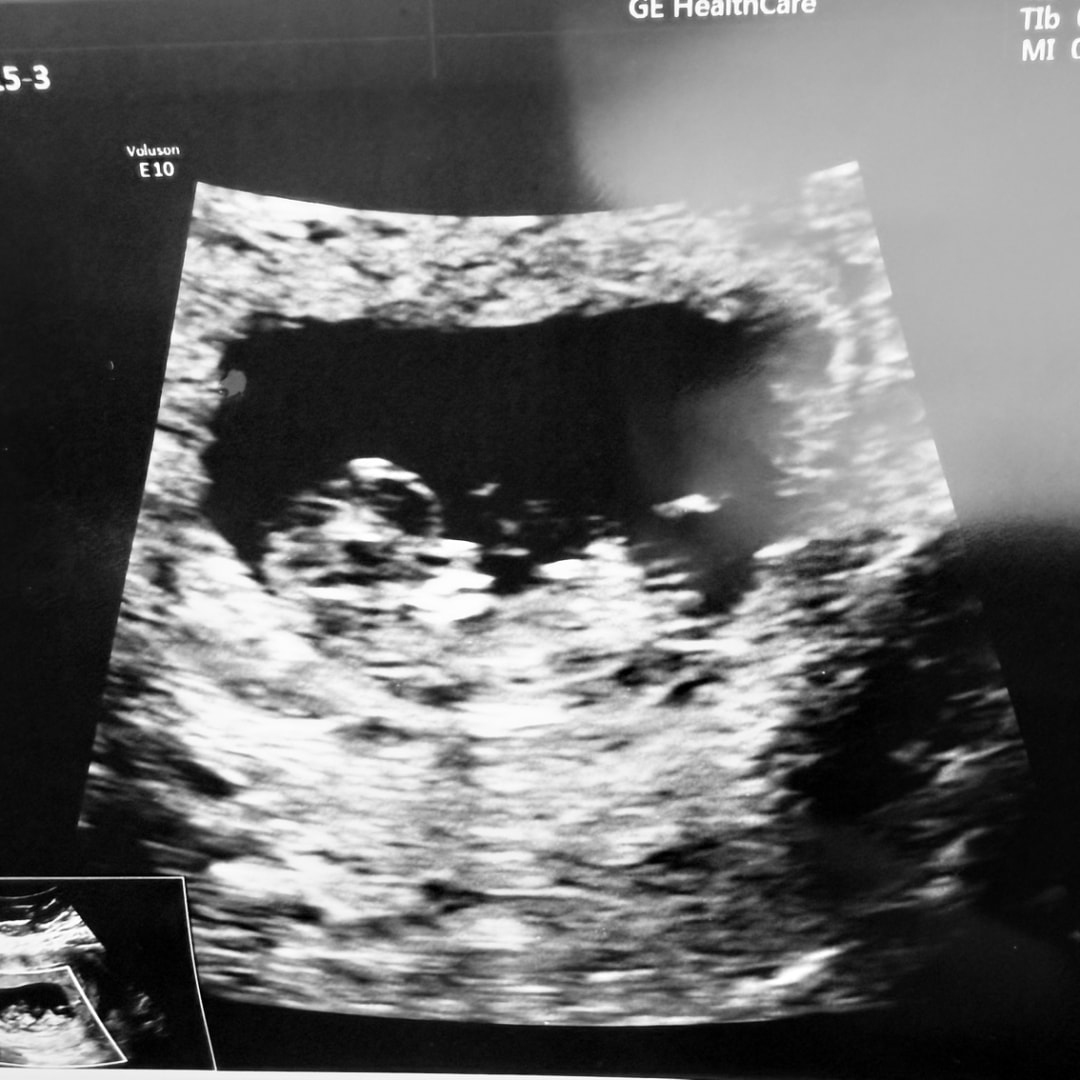 Photo shared by Brytney for their Babylist baby registry.