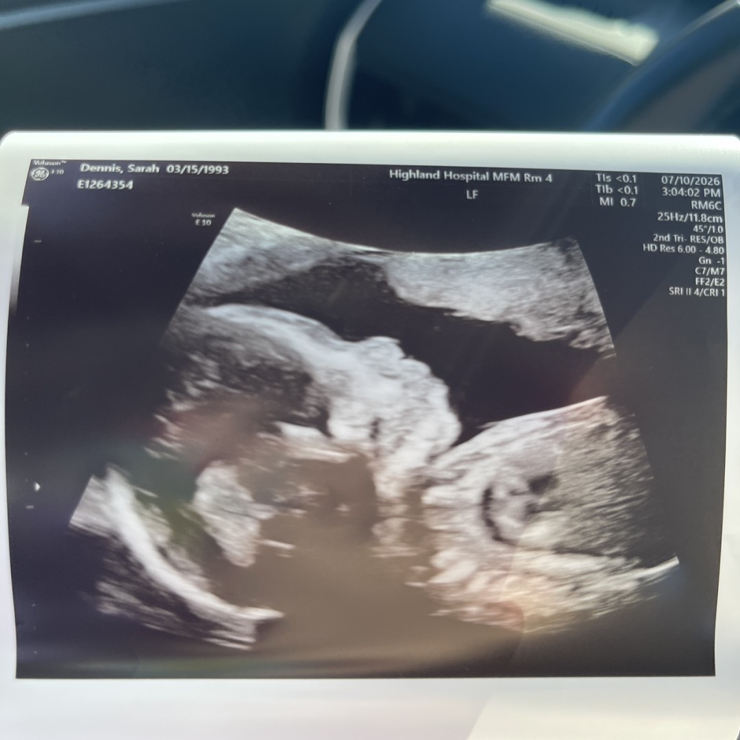Photo shared by Sarah for their Babylist baby registry.