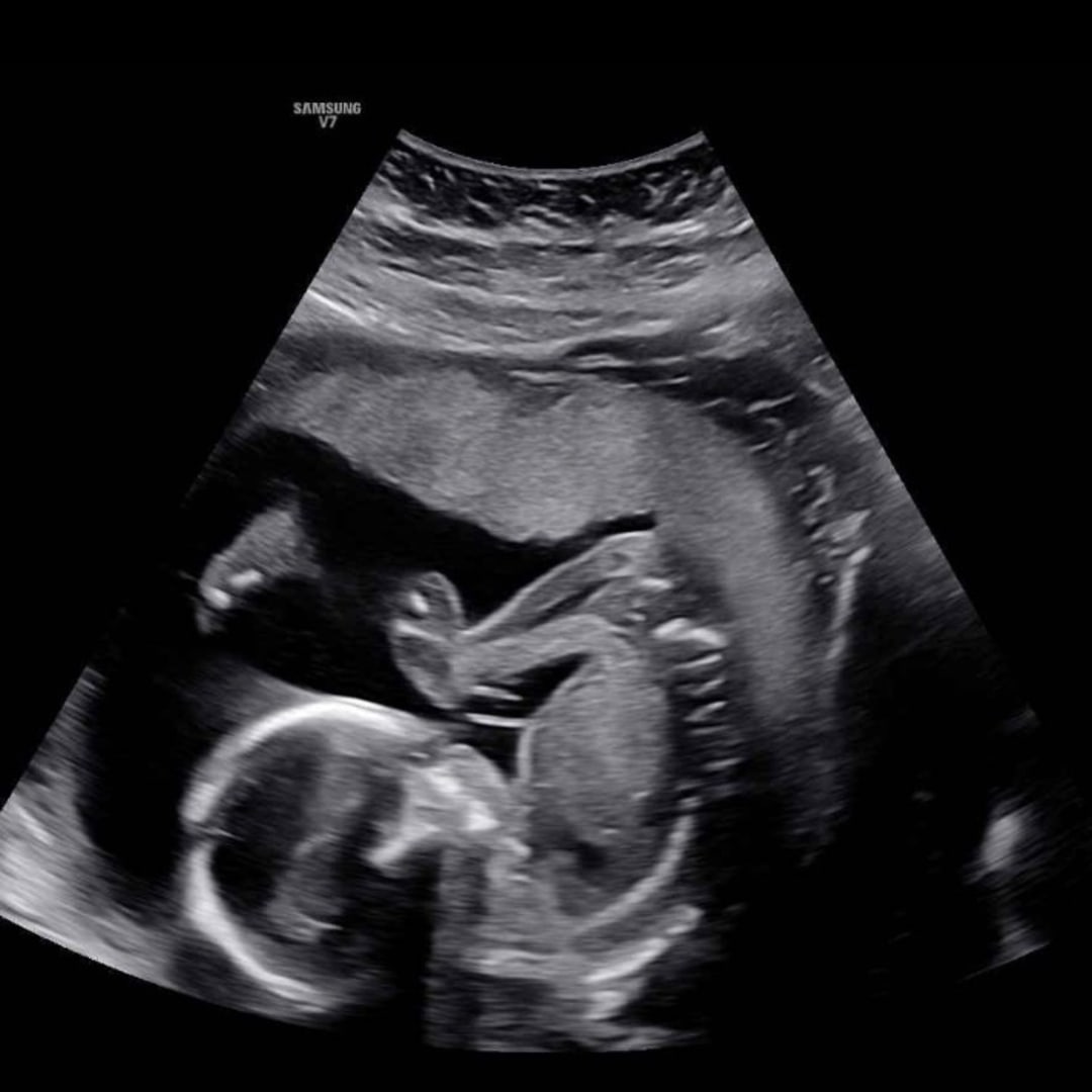 Photo shared by Sophia for their Babylist baby registry.