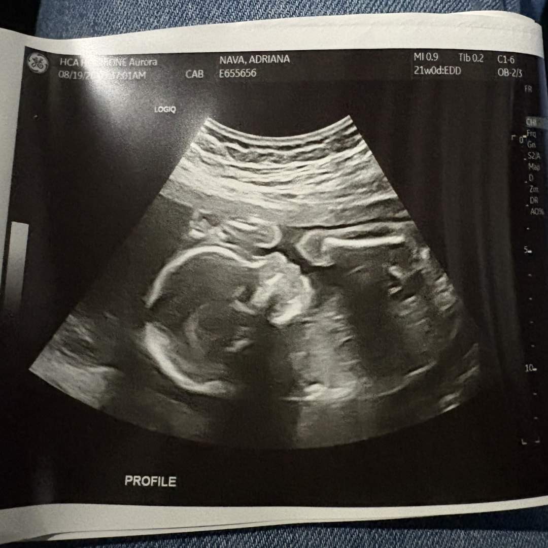 Photo shared by Adriana for their Babylist baby registry.