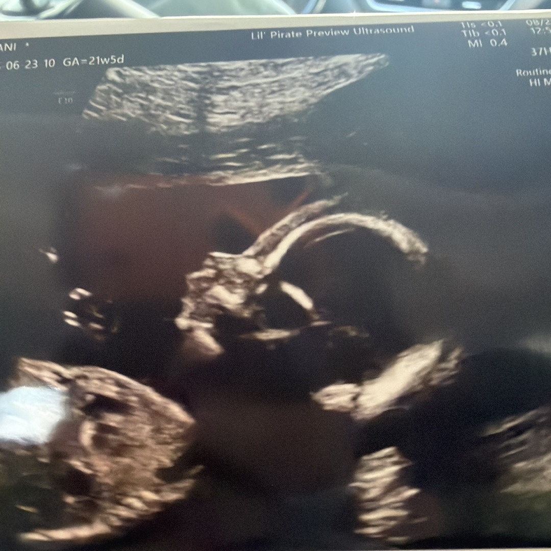 Photo shared by Alani for their Babylist baby registry.