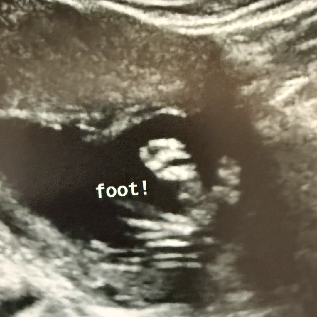 Photo shared by Breahna for their Babylist baby registry.