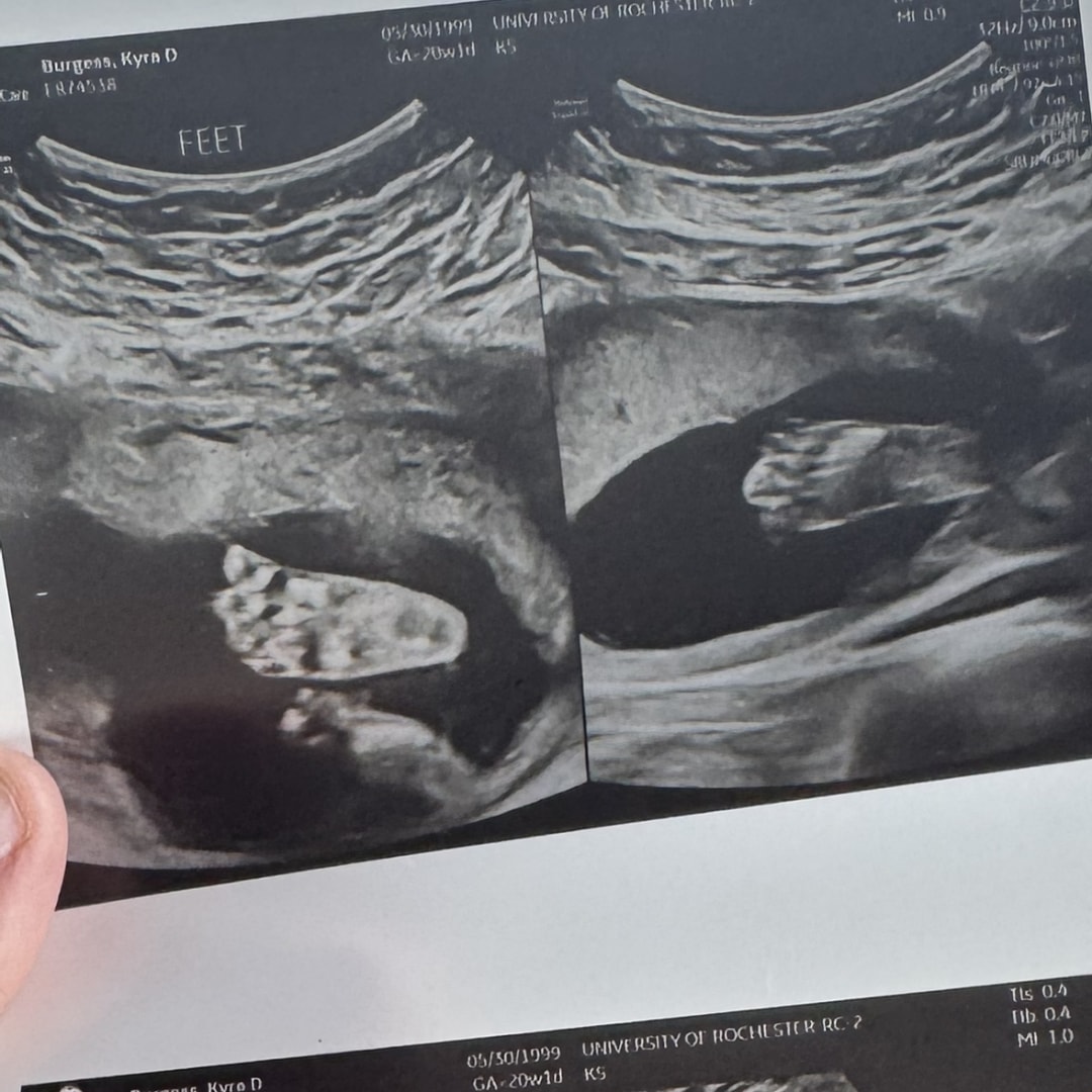 Photo shared by Kay for their Babylist baby registry.