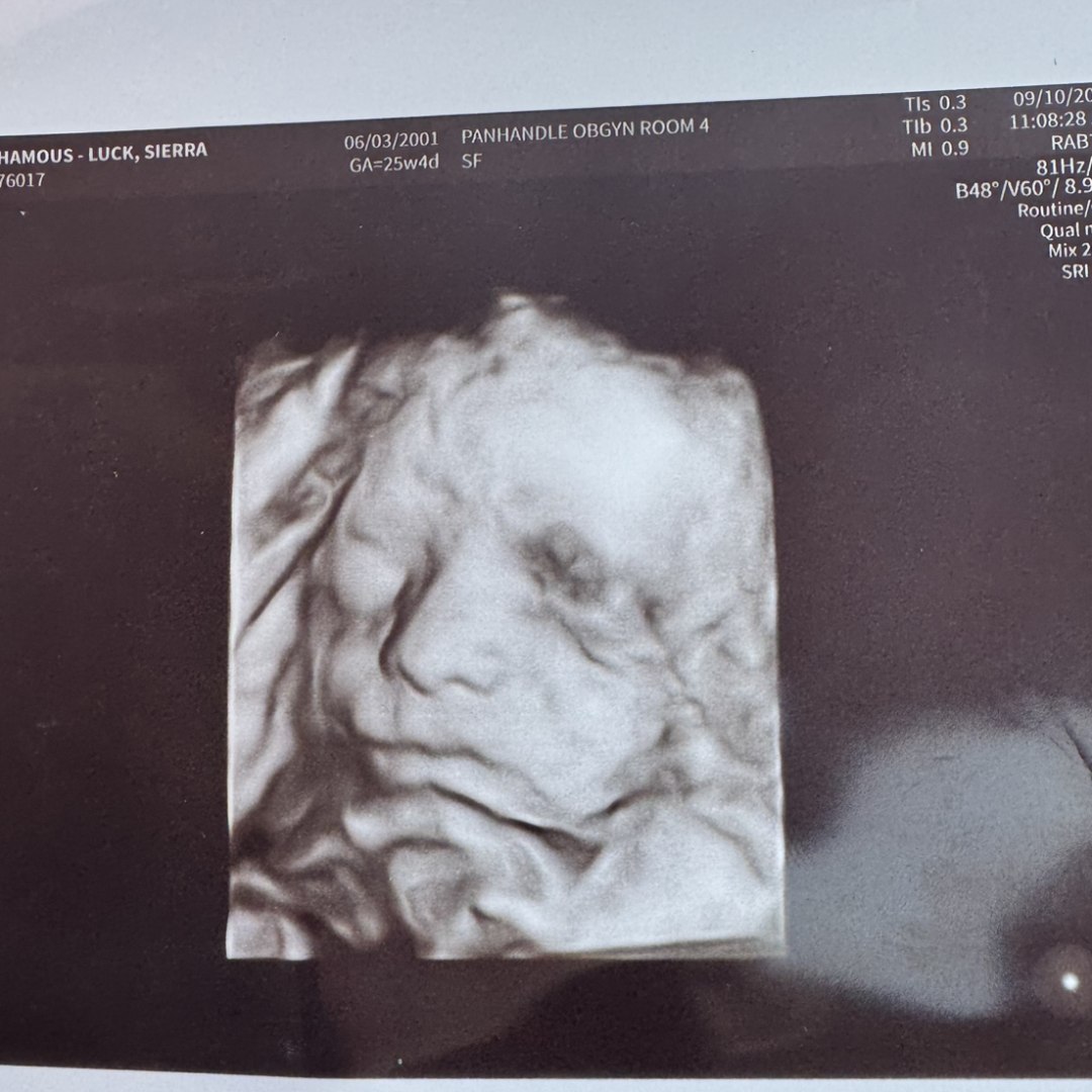 Photo shared by Sierra for their Babylist baby registry.