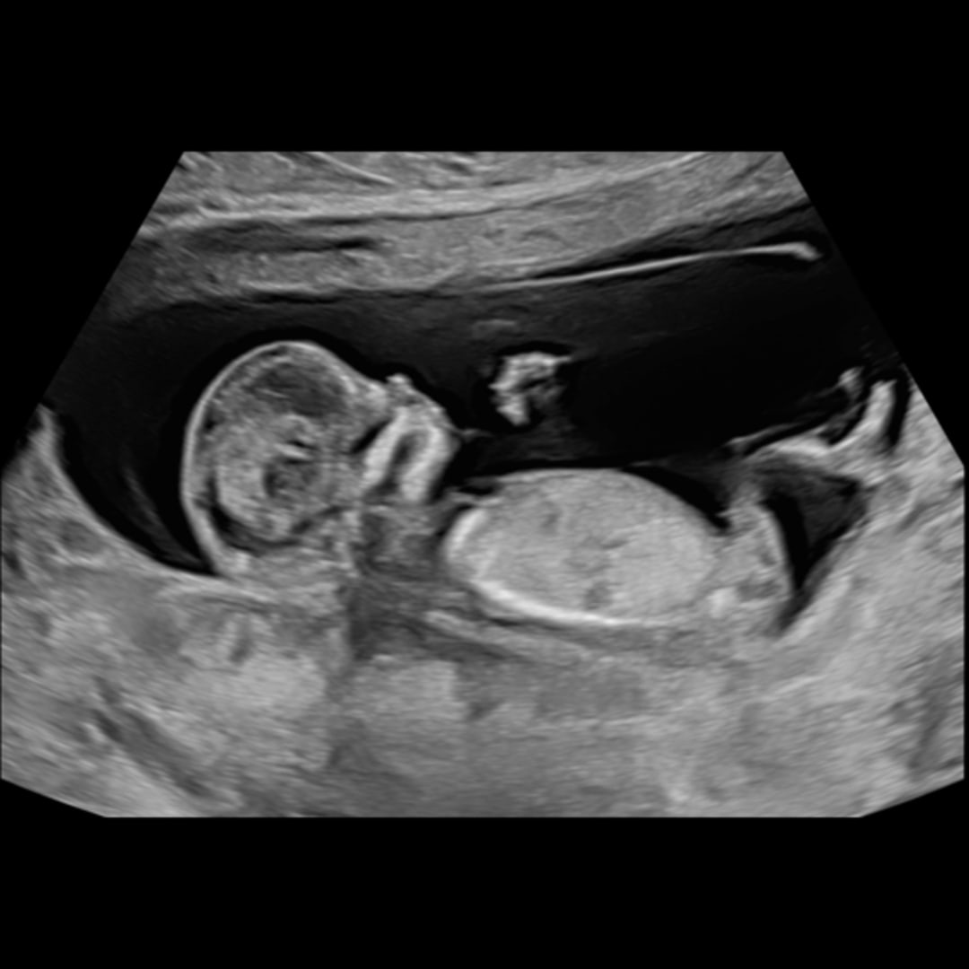 Photo shared by Ciera for their Babylist baby registry.