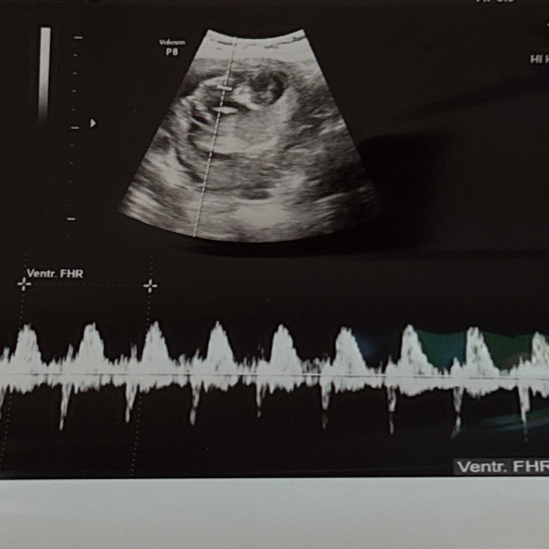 Photo shared by Iris for their Babylist baby registry.